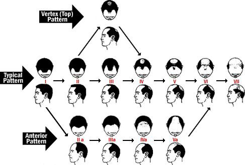 Hair Classification